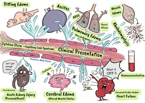 Capillary leak syndrome